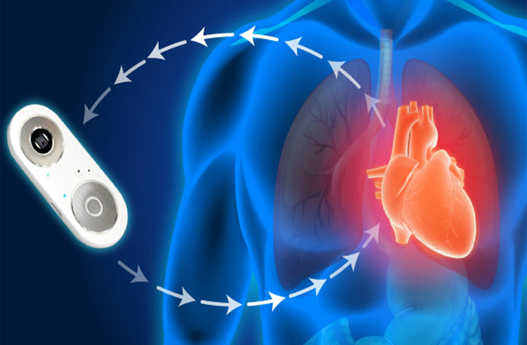 iCARE: Máy đo tim mạch bằng ngón tay cái trong 60 giây mỗi ngày